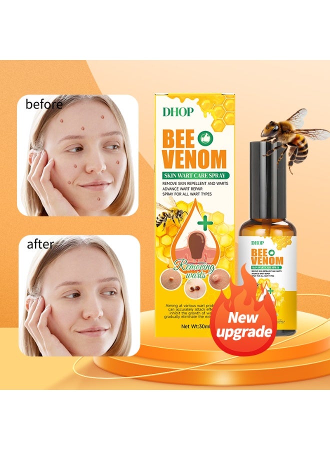 DHOP Bee Venom Skin Wart Care Spray Wart Removal & Repair Dual-Effect All Wart Types 30ml Topical Skin Care Spray - Image 2
