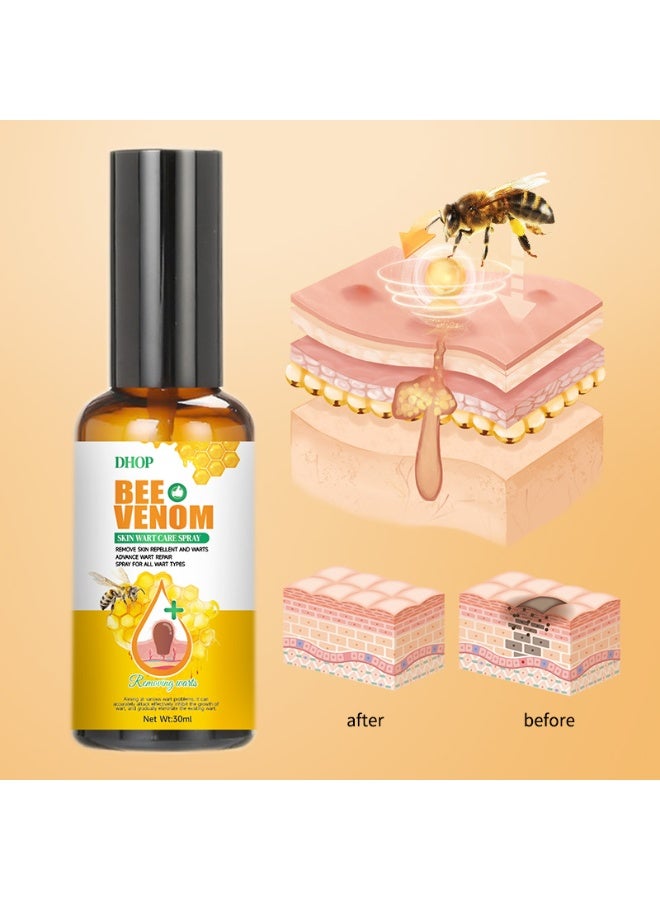 DHOP Bee Venom Skin Wart Care Spray Wart Removal & Repair Dual-Effect All Wart Types 30ml Topical Skin Care Spray - Image 5