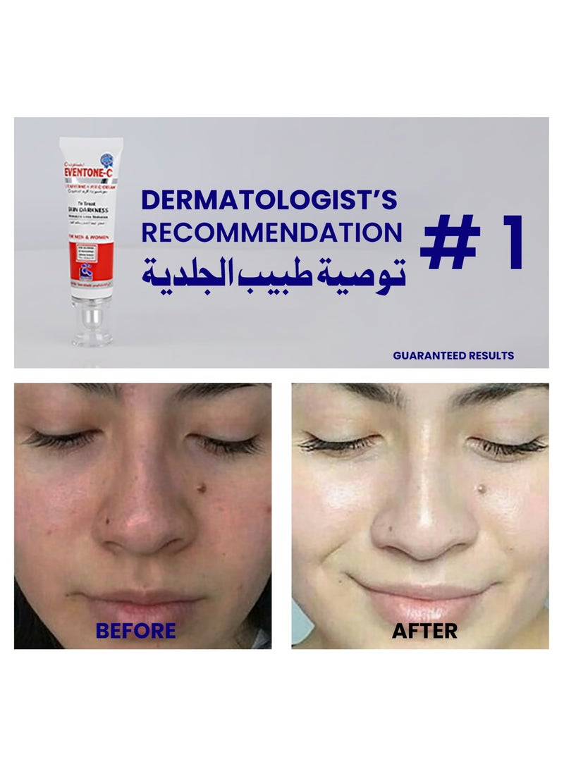 PharmaHealth Eventone C Cream 30g | Skin Brightening & Even Tone Moisturizing Cream with L-Glutathione & Vitamin C | Reduces Marks, Dark Spots & Fine Lines - Image 5