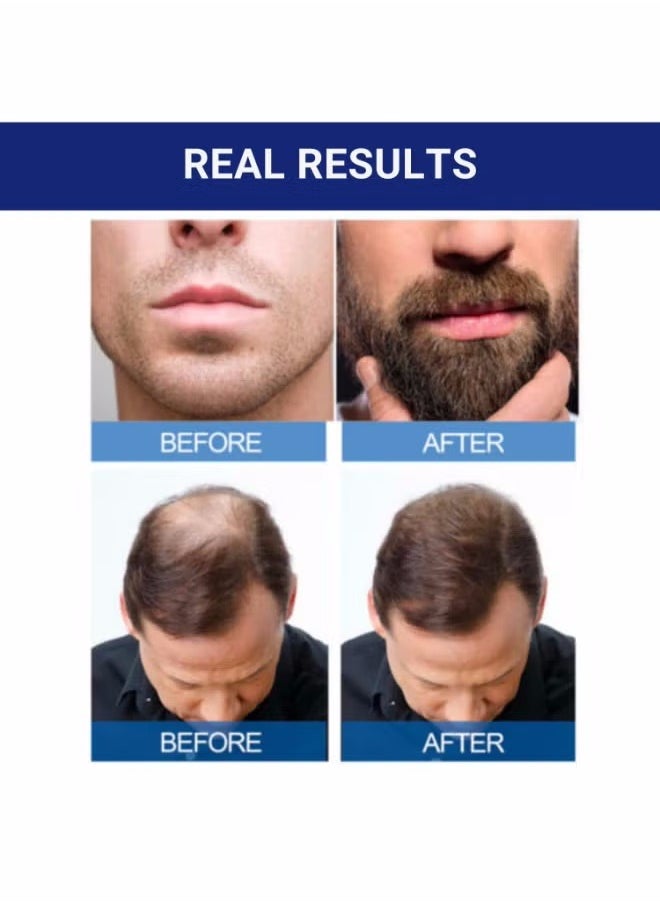 Kirkland Signature - 2-Piece Minoxidil 5% Extra Strength Hair Regrowth Treatment 60ml - Image 1