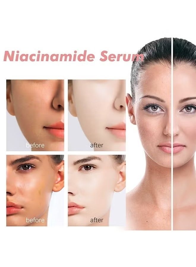 هويجي الخوخ 70% نيكوتيناميد الجوهر 30ml / مرطب الوجه جوهر علاج تصبغ يقلل من الميلانين يوميا التطهير والتجميل ( 1.01 أوقية ) - Image 2