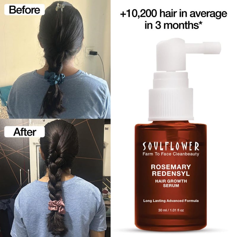 Soulflower Soulflower Hair Growth Serum Rosemary Oil 3 Redensyl 4 Anagain Caffeine Melanogray Biotin Rice Water Clinically Tested on Real people Hair growth  Hair fall control for Women  Men  30ml - Image 5