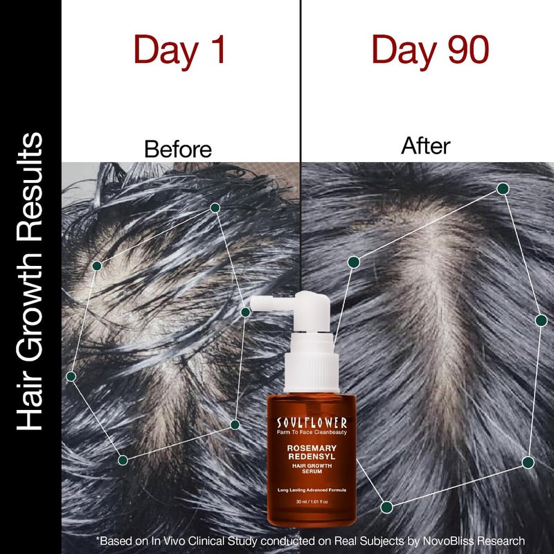 Soulflower Soulflower Hair Growth Serum Rosemary Oil 3 Redensyl 4 Anagain Caffeine Melanogray Biotin Rice Water Clinically Tested on Real people Hair growth  Hair fall control for Women  Men  30ml - Image 4