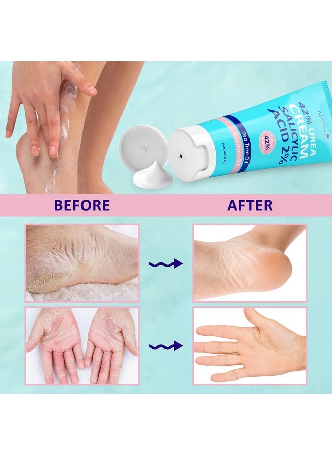 ASDToTio - Urea Cream 42% - Foot Care for Dry Cracked Heels, Foot Lotion - With 2% Salicylic Acid, Tea Tree Oil, Shea Butter, Aloe Vera - For Feet, Hands, Heels, Elbows, Knees and More - 4 oz - Image 1