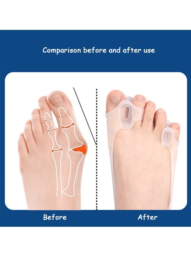 MXN 4 Pcs Soft Elastic Silicone Bunion Corrector Toe Separators Sleeves, Toe Straightener Relief Pain for Hallux Valgus Overlapping Toes - Image 5