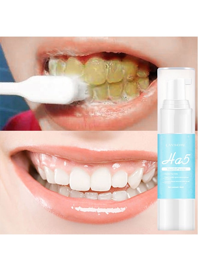Lanthome - Ha5 Toothpaste，Teeth Whitening Toothpaste, HA5 Hyaluronic Acid Gum Foam Repair Toothpaste, Strong Stain Remover Toothpaste, Toothpaste for Sensitive Teeth, Repair Teeth and Improve Oral Hygiene (Blue-Repair) - Image 1