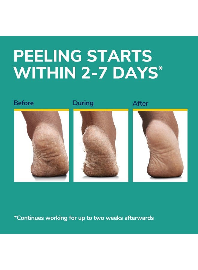دكتور شولز قناع دكتور شول لتقشير القدمين فائق التقشير للبشرة الجافة والخشنة، 3 أزواج من الجوارب المرطبة، يقشر وينعم بلطف، مع اليوريا، مزيل مسامير القدمين الجافة - Image 4