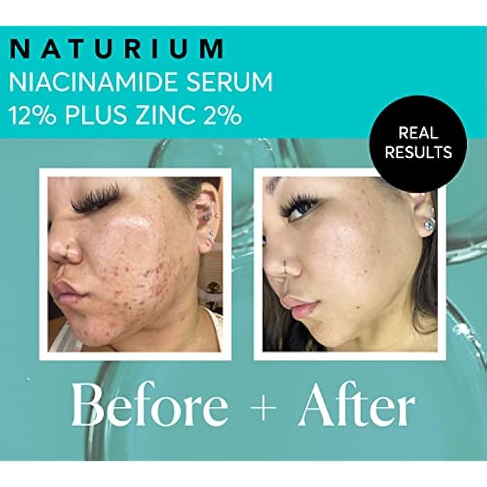 Naturium Niacinamide Face Serum 12% Plus Zinc 2%, Anti-Aging, Pore Minimizer & Dark Spot Corrector with Hyaluronic Acid & Vitamin E, Vegan & Cruelty-Free, 1 oz - Image 5