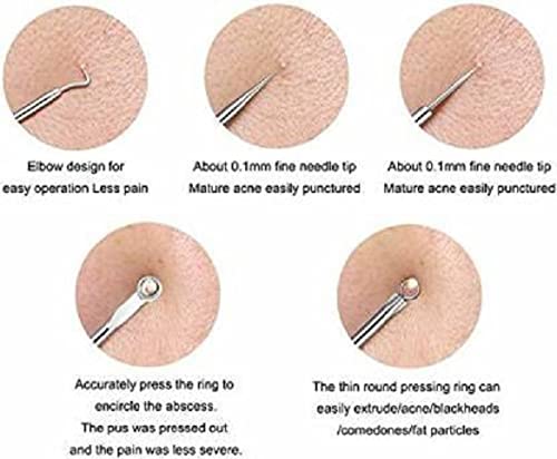 Elecsera Blackhead Comedone Acne Blemish Remover Stainless Needles Remove Tool Kit Silver Pack of 4 - Image 3