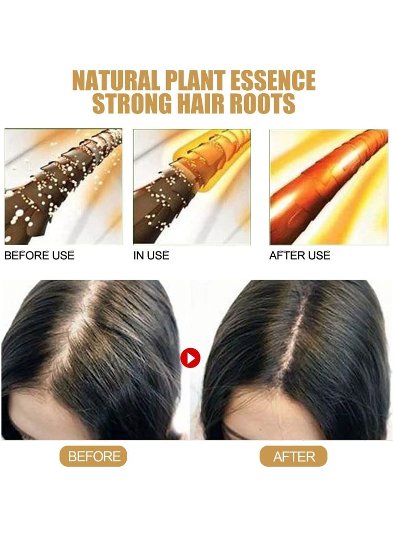 جينجر صابونة شامبو الزنجبيل لإعادة نمو الشعر، صابونة شامبو الزنجبيل لإعادة نمو الشعر، صابونة شامبو صلبة، شامبو ضد تساقط الشعر، يعزز نمو الشعر الصحي، عبوة من قطعتين - Image 5