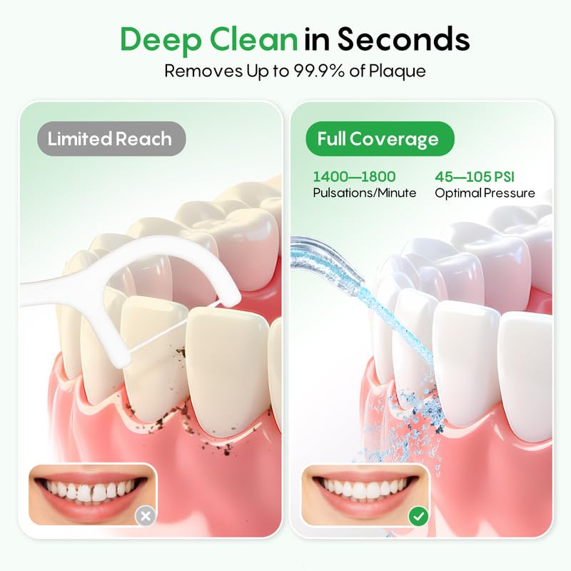 FRESKO Water Dental Flosser for Teeth, 300ML Cordless Flosser with Constant Pressure, Rechargeable Oral Irrigator Cleaner for Travel Home Use and Braces Care, IPX7 Waterproof, 5 Jet Tips - Image 2