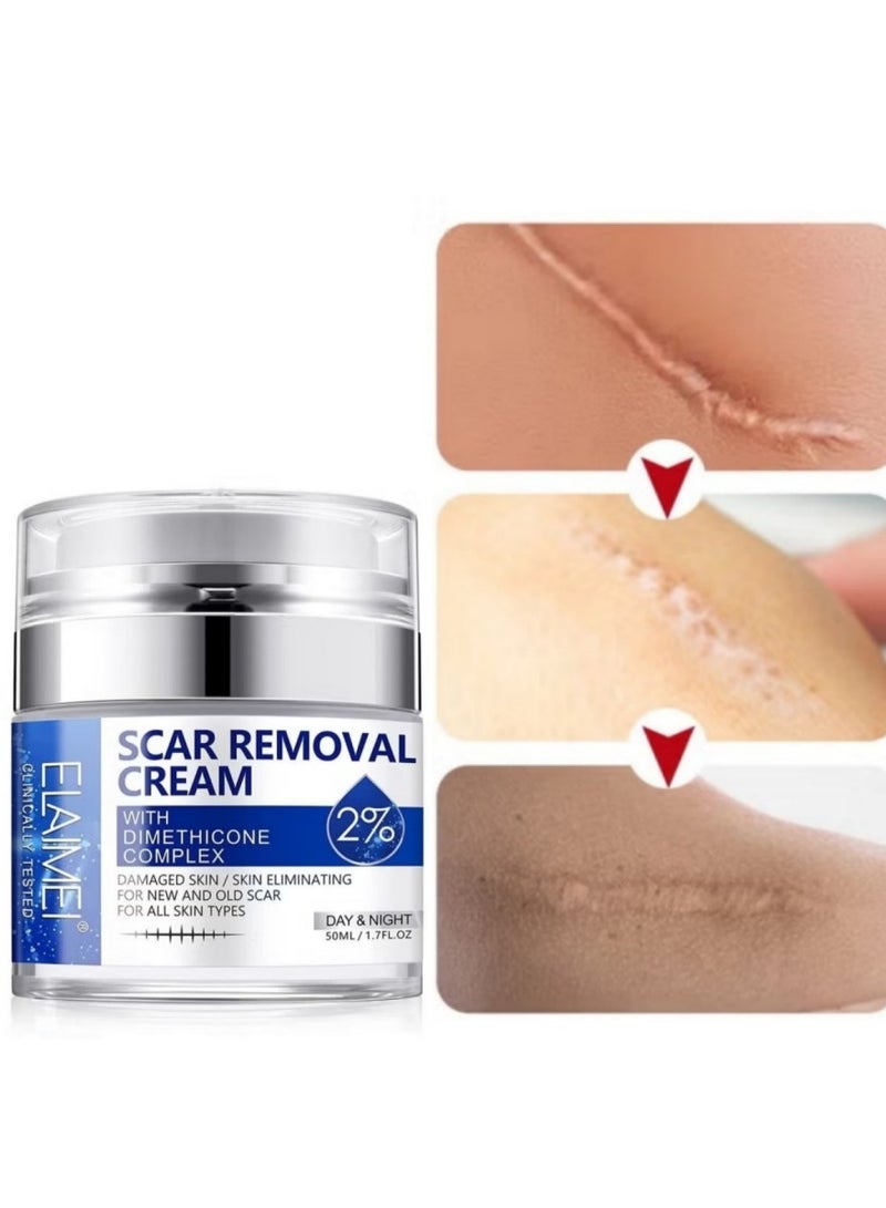 Elaimei Scar & Stretch Mark Removal Cream 50ml – Advanced Dimethicone Complex for Old & New Scars | 100% Retinol-Free Formula | Natural Skin Repair for Men & Women - Image 2