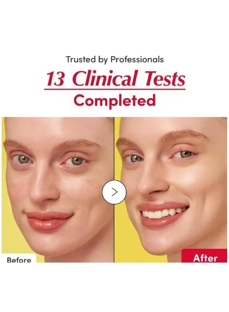 إيكوالبيري Eqqualberry Vitamin C Serum مع 15 ٪ مستخلص Acerola و 5 ٪ niacinamide | مجمع حمض السيراميد هيالورونيك لإصلاح الحاجز والترطيب العميق (30 مل/1.01 أوقية) - Image 4