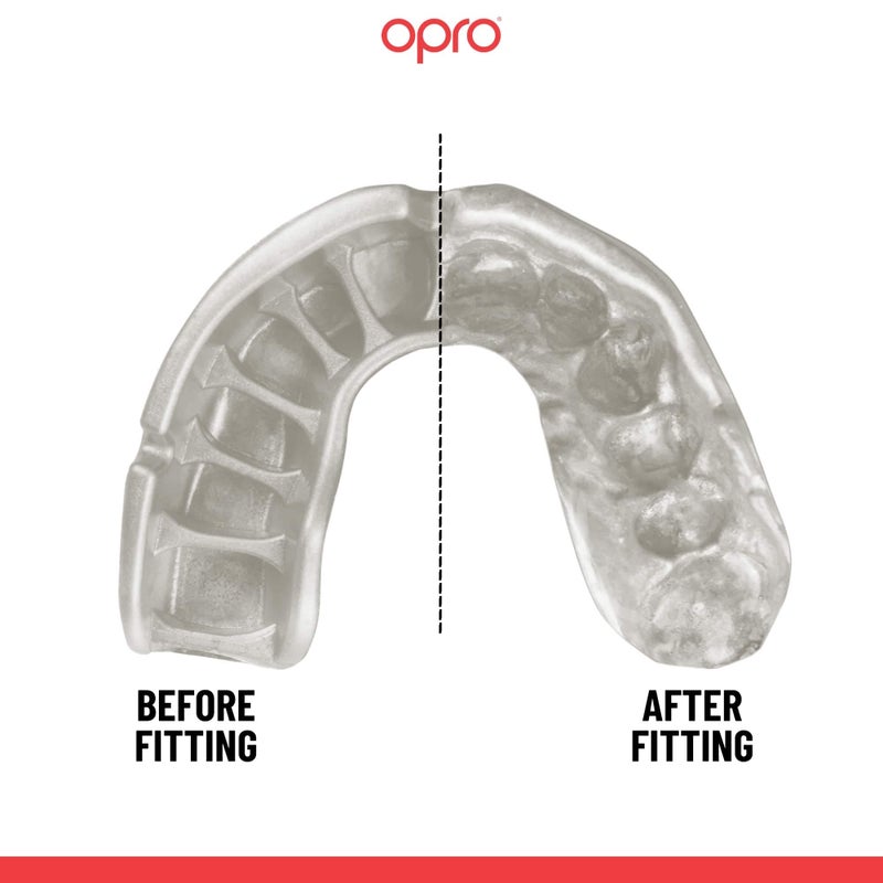 OPRO Instant Custom-Fit Mouth Guard, Dentist-Level Comfort, Protection & Fit - Moldable Mouthguard for Football, Boxing, Rugby, MMA, BJJ, UFC Mouth Piece- Includes Mouth Guard Case (Black, Youth) - Image 4