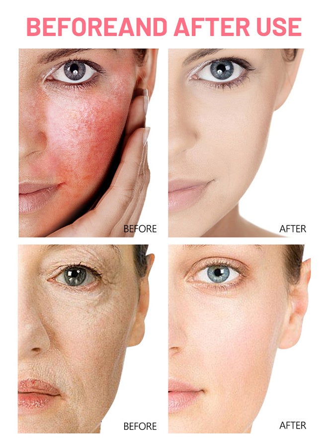 ديسار سيروم مرطب الوجه الوردي المضاد للشيخوخة ومضاد للتجاعيد وخلاصة ناعمة يحسن بشرة الوجه العناية اليومية بالبشرة ، وتفتيح وترطيب وشد وتكشف عن بشرة متألقة ، 30 مل - Image 3