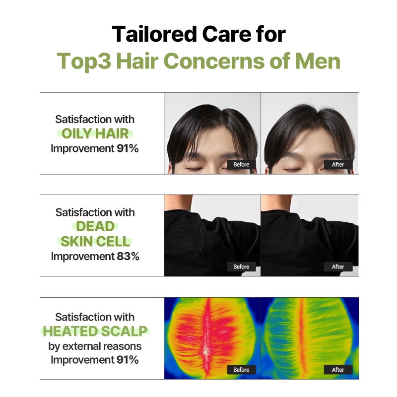 Ryo Root:Gen Hair Strength Shampoo For Men - Image 5