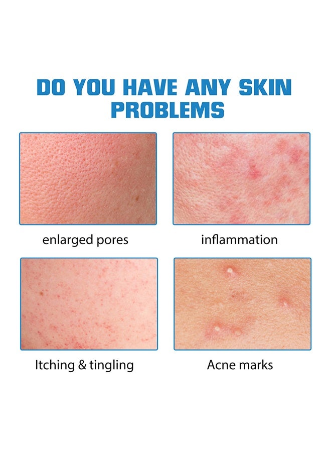 EELHOE Hyaluronic Acid-Face Serum, Suitable for Enlarged Pores, ltching & Tingling,Inflammation,Acne Marks, Antibacterial, Restore Skin Health 10ml - Image 4