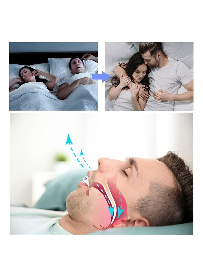 Anti-Snoring Mouthpiece Sleep Aid Device for Teeth Grinding and Snore Prevention - Image 3