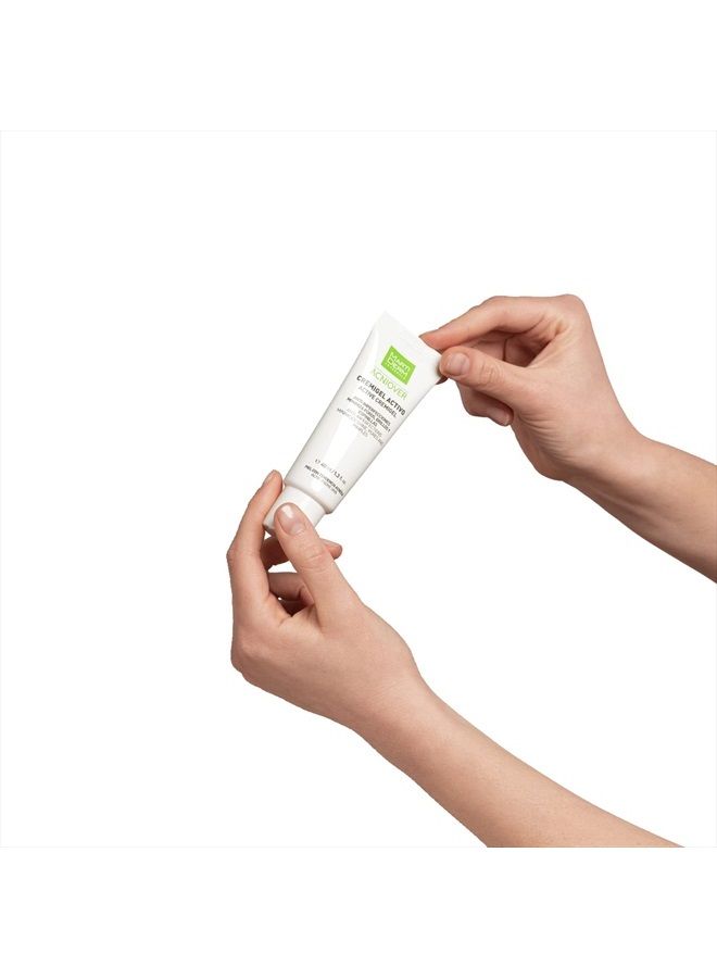 Martiderm Acniover Cream-gel 40ml - Image 4