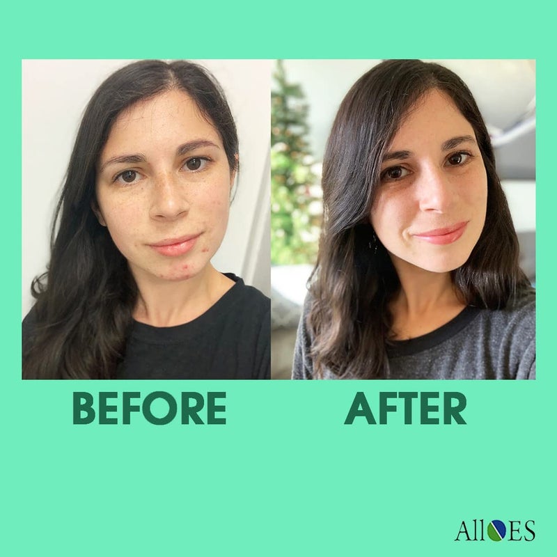 ALLOES PHARMACEUTICALS ALLOES Neem Face Wash for OilyAcne ProneNormal Skin Daily Use Cleanser For Women Men Prevents PimplesPores And Blackheads 75 gram each pack of 2  - Image 4