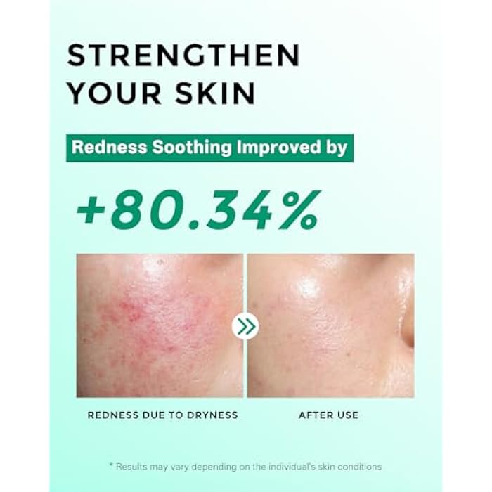 FeeMeFee Azelaic Acid Serum,10% Azelaic Acid for Face – 20,000ppm Niacinamide, 5,000ppm Vitamin B5 – Centella Asiatica & Hyaluronic Acid - Soothe Redness, Refine Texture, and Hydrate, Korean Skincare 1 Fl Oz - Image 5