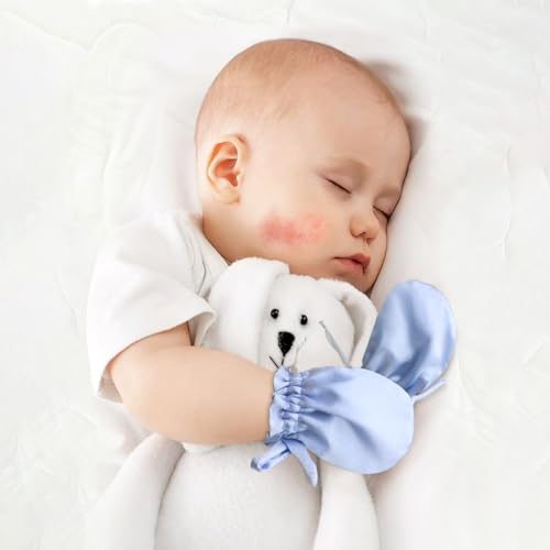 pinklilycare 1 Pair Satin Eczema Mittens for Babies Eczema Gloves Anti Scratch Eczema Relief Mittens Adjustable - Image 5