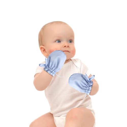 pinklilycare 1 Pair Satin Eczema Mittens for Babies Eczema Gloves Anti Scratch Eczema Relief Mittens Adjustable - Image 1