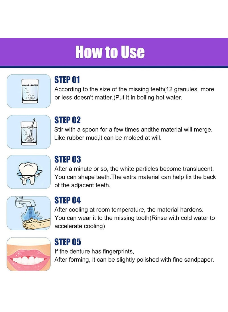 HOMTOPY - Tooth Repair Kit, 30ml Moldable Teeth Glue 4 Dental Tools Temporary Tooth Filling Set Dental Care Kit DIY at Home, Suitable for Men and Women - Image 1
