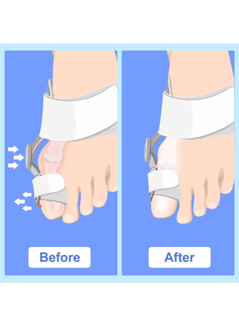 Sweet seven 2 Pack Bunion Corrector Set - Toe Splint for Bunion Relief and Big Toe Straightening - Day and Night Support for Men and Women  - Image 4
