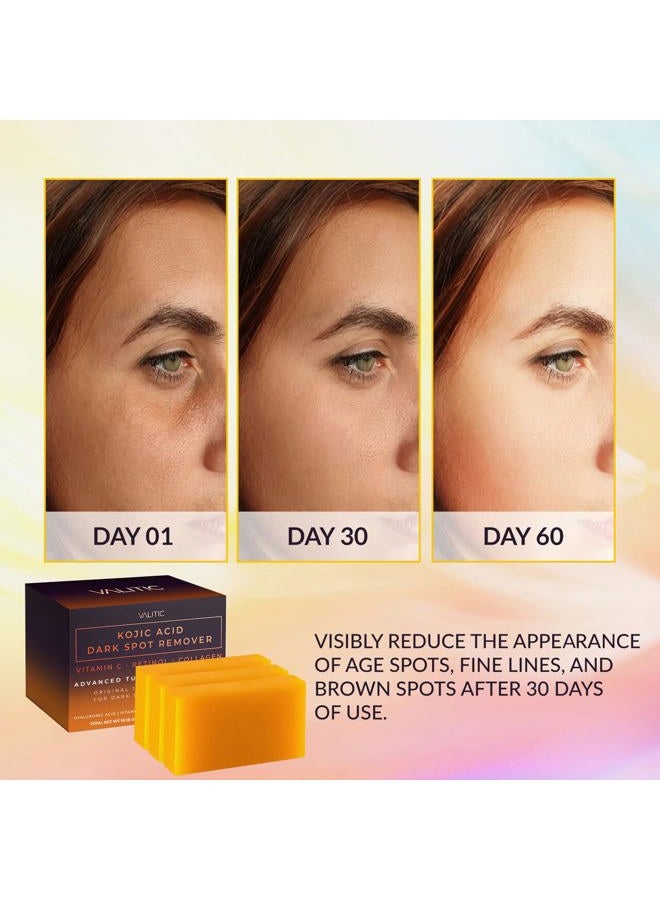 VALITIC Kojic Acid Dark Spot Remover Soap Bars with Vitamin C, Retinol, Collagen, Turmeric - Original Japanese Complex Infused Hyaluronic Acid, E, Shea Butter, Castile Olive Oil (3 Pack), 3.5 Oz - Image 2