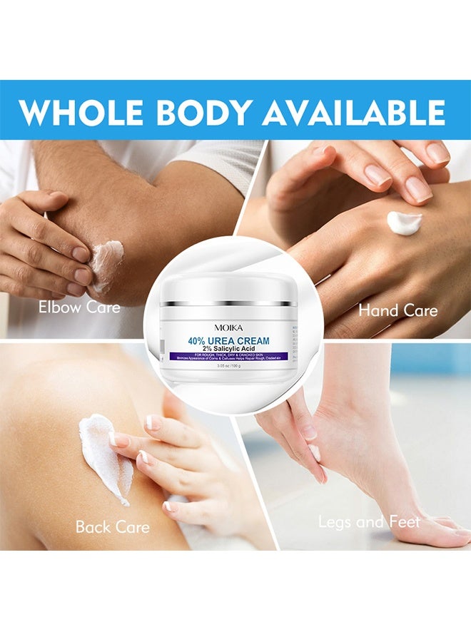 مويكا كريم اليوريا - 40٪ بالإضافة إلى حمض الساليسيليك 2٪ ، كريم القدم للكعب الجاف المتشقق ، القدمين ، الركبتين ، المرفقين ، اليدين ، الجلد الميت للبشرة ، مزيل الكالس ، منعم أظافر القدم ، إصلاح حاجز البشرة المحلل للقرنية - Image 4
