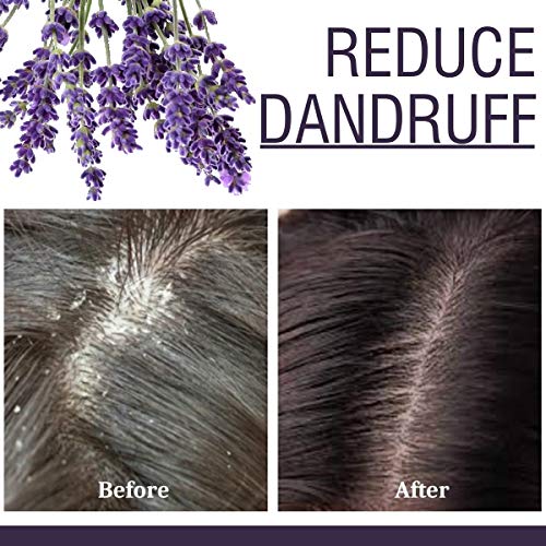 Old Tree Lavender Essential Oil for Home Fragrance (15ml) - Pure & Natural Lavender Oil for Skin, Hair growth, Sleep, Diffuser, Soap Making - Essential Oil with Dropper for Aromatherapy and Relaxation - Image 5