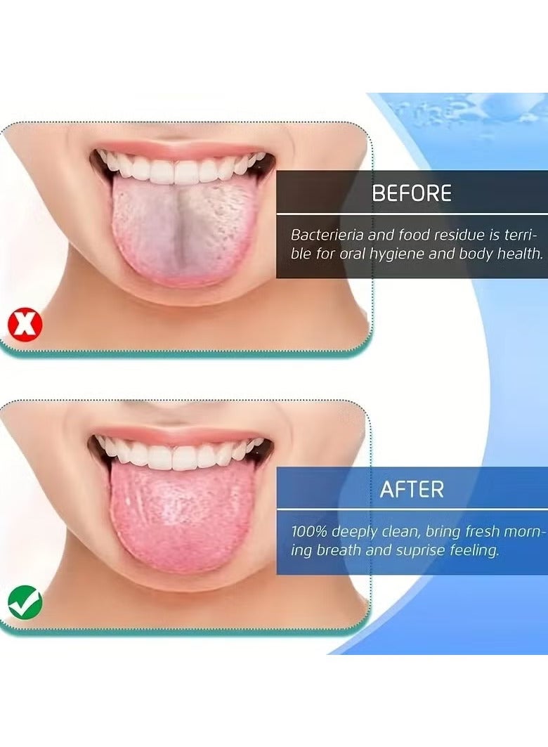 اترجسز 3 لون الفولاذ المقاوم للصدأ اللسان مكشطة يو على شكل معدن التنفس النقي تنظيف فرشاة الأسنان المغلفة اللسان صحة الفم أدوات الرعاية - Image 2