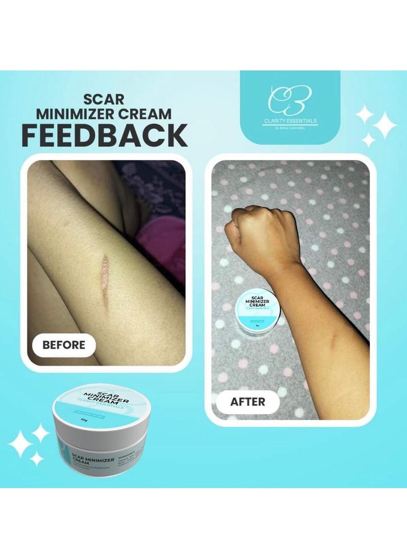 CLARITY - Scar Remover Cream - Scar minimizer cream 10g | Clarity Essentials Peklat Cream - Image 1