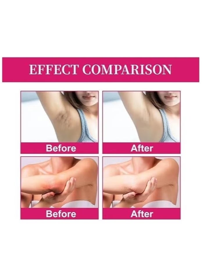 KOJIC ACID Kojic Acid Skin Lightening Cream, Underarm Cream, Intimate Area Dark Spot Remover, for Body, Underarms, Armpit, Knees, Legs and Inner Thigh Cream for Acanthosis Nigricans, Non-Greasy - Image 5