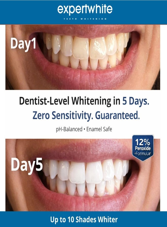 Expertwhite MaxStrips - Teeth Whitening Strips – 12% Peroxide, no-Slip Dryfit Strip, pH Balanced, Enamel Safe, Zero Sensitivity, Non-Residue whitening Strips. (28 Strips, 14 Treatments - Image 2