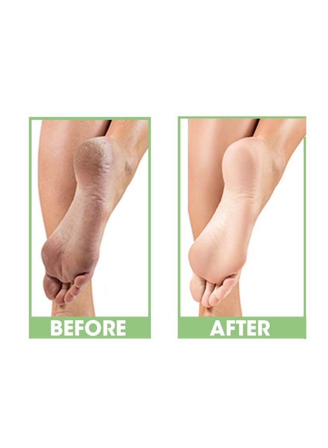 ProLinc Dry Heel Eliminator Protect And Hydrate Dry Heels And Feet Fast Absorbing And Non Greasy Made In The Usa 4 Fl. Oz. - Image 3