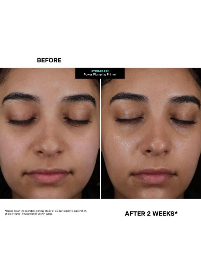 كيت سمرفيل برايمر كيت سومرفيل هيدرا كيت باور بلومبينج