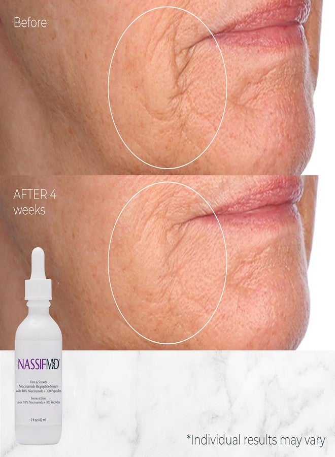 NassifMD Niacinamide Serum 10% with Cranberry Biopeptides and Ectoin, Brightening and Hydrating Vitamin B3 Face Serum, Evens Tone, Smooths Texture, Reduces Fine Lines, Boosts Radiance - Image 2