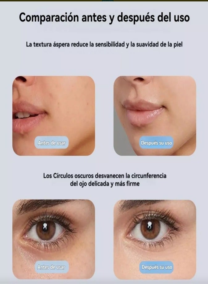 Facial Massager | 3 Modes for All Skin Types | LED Phototherapy | Tightens Jawline - Image 5