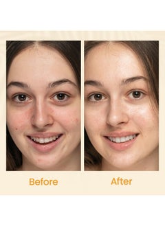 Honeyskin Honeyskin Gel Moisturizer for face - Lightweight Water Gel Infused with Coconut water with Niacinamide & Peptides for Deep Hydration - Hypoallergenic Face Moisturizer for Women 2oz  - Image 5