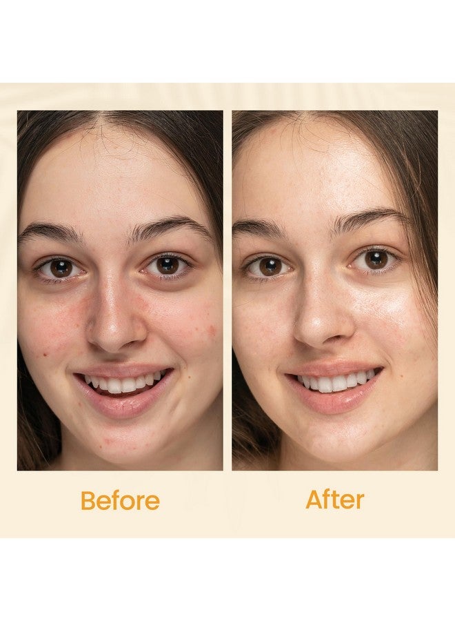 Honeyskin Gel Moisturizer for face - Lightweight Water Gel Infused with Coconut water with Niacinamide & Peptides for Deep Hydration - Hypoallergenic Face Moisturizer for Women 2oz - Image 5