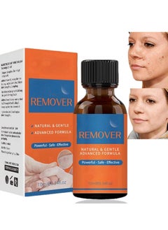Excefore Warts & Mole Remover Cream,Natural Skin Tag Remover,Skin Tag Remover for Face & Hands & Body,Natural Formula,Skin Tag Remover Liquid,Tags and Mole Remover,Fast-Acting & Effective Skin Tag Remover  - Image 1