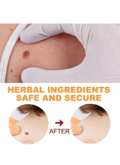 Excefore Warts & Mole Remover Cream,Natural Skin Tag Remover,Skin Tag Remover for Face & Hands & Body,Natural Formula,Skin Tag Remover Liquid,Tags and Mole Remover,Fast-Acting & Effective Skin Tag Remover  - Image 5