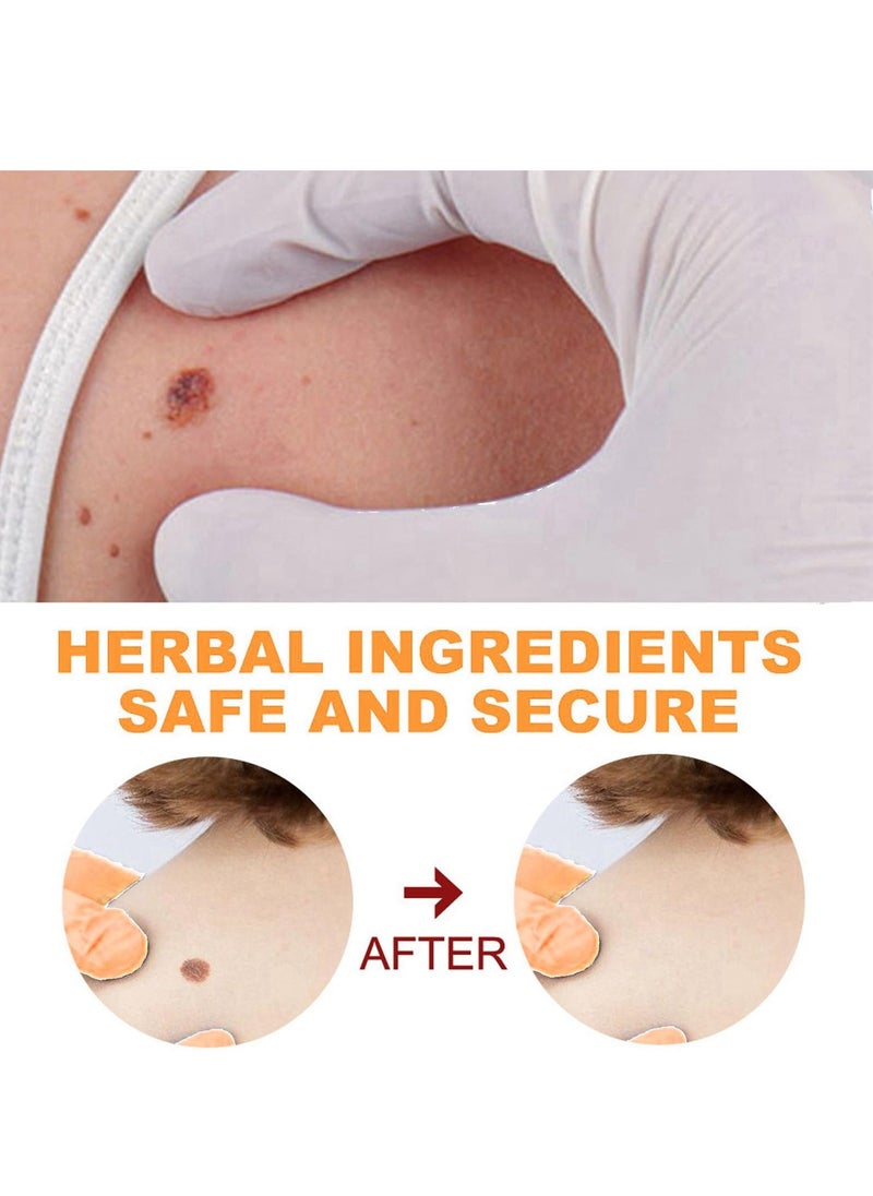 Excefore Warts & Mole Remover Cream,Natural Skin Tag Remover,Skin Tag Remover for Face & Hands & Body,Natural Formula,Skin Tag Remover Liquid,Tags and Mole Remover,Fast-Acting & Effective Skin Tag Remover  - Image 5