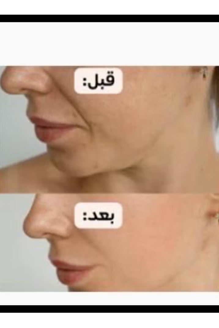 باليا زيت زهرة الفولين الياباني 100 مل - Image 2