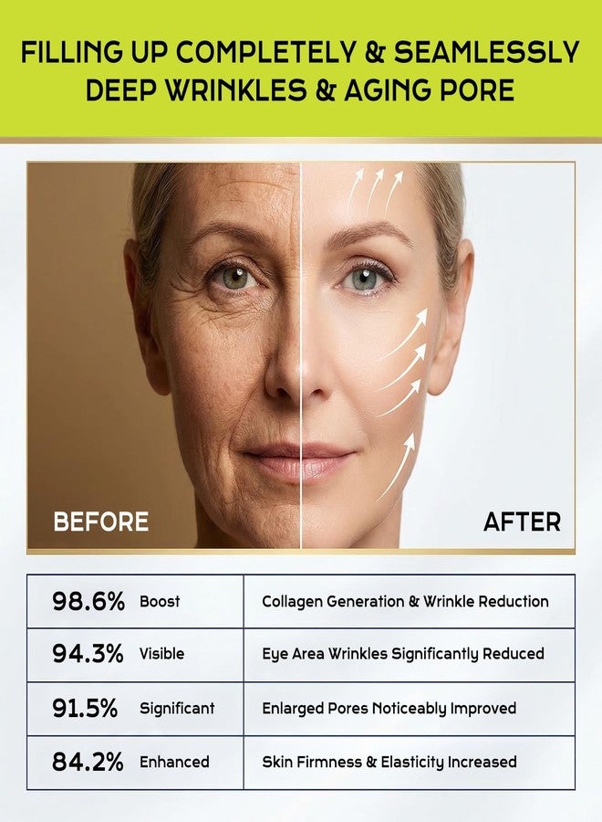 Manoai Vita-A Retinol Shot Wrinkle-Lift Tightening Cream, High-Strength Retinoid for Lift Cream - Natural Pore Minimizer, Wrinkles & Fine Lines for All Skin (4) - Image 4