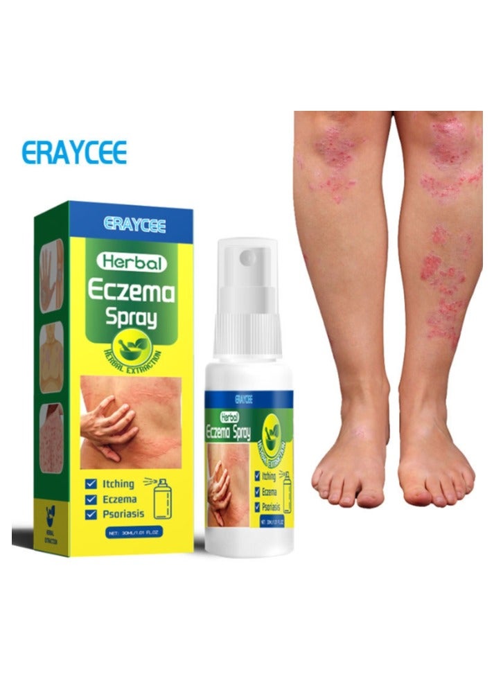 ERAYCEE Eczema Spray 30ml, Skin Soothing and Refreshing, Antibacterial Action, Plant Extracts, Itch Relief, Anti-Inflammatory Properties, Hydrates and Moisturizes, Cooling Sensation - Image 1