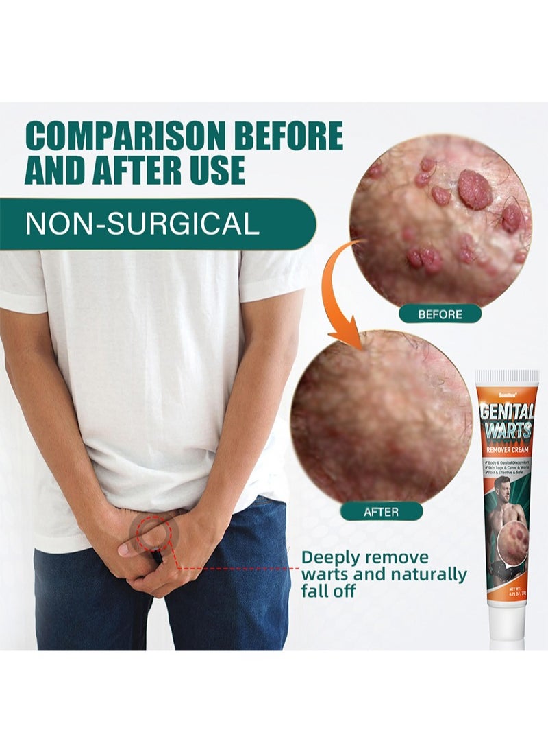 Genital Wart Off, Genital Wart Removal Cream 0.7oz Easy Absorption Soften Cuticle Pointy Condyloma Removing Cream Remove Common Warts, Plantar Warts, Genital Warts