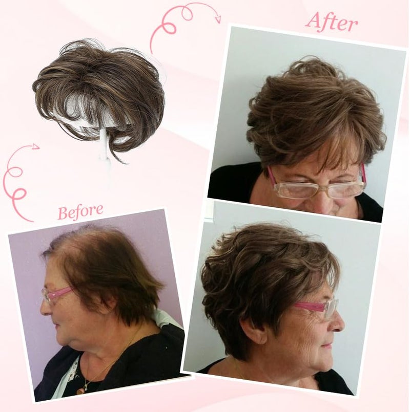 UDU Hair Topper Short Pixie Cut Toppers for Women with Thinning Hair Synthetic Wiglet Toppers Instant Volume & Fullness, Natural-Looking & Lightweight, Boosting Confidence - Image 4